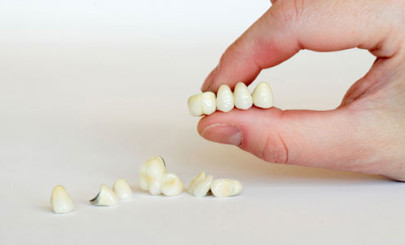 металлокерамические зубы
