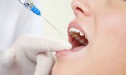 анестезия при лечении зубов у беременных