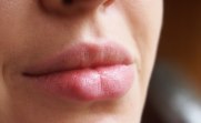 причины появления белых точек на губе