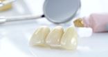 зубные протезы из дентальной керамики
