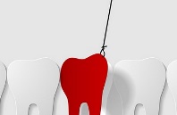 остановить кровотечение после удаления зуба