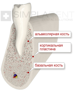 Зуб и кость на схеме