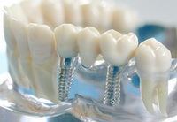как проводится протезирование зубов без обточки