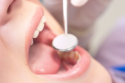В вопросах лечения зубов очень важно не заниматься самолечением.