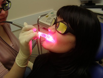 Лечение зубов лазеров - процедура совершенно безболезненная.