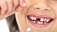  в каком порядке выпадают зубы у детей