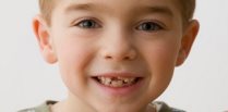 выпадать молочные зубы у детей