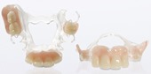 ацеталовый зубной протез