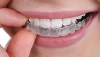 выравнять зубы прозрачными каппами