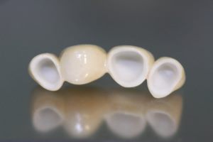 циркониевые зубные коронки