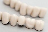 фарфоровые коронки на зубы