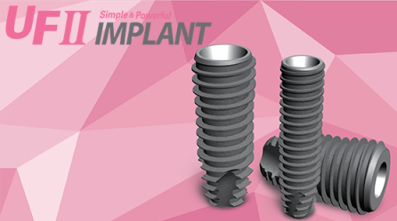 UF II Implant 