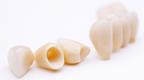 какие зубные протезы могут изготавливаться из керамики